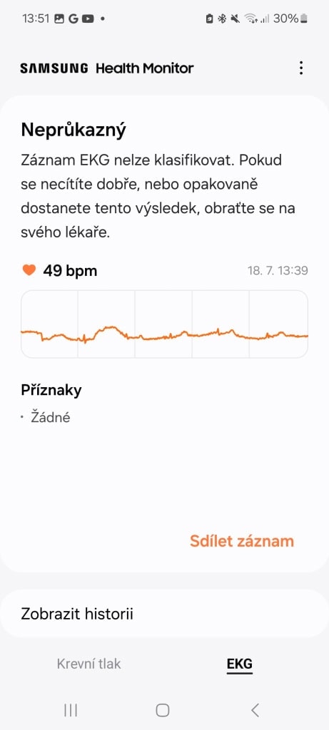 EKG-mérések rögzítése
