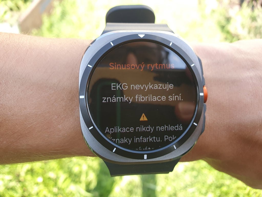 Az órán lévő EKG csak a pitvarfibrilláció kimutatására szolgál.