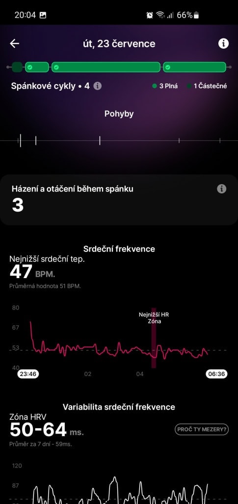A gyűrű az alvási pulzusszám-változékonyságot is méri