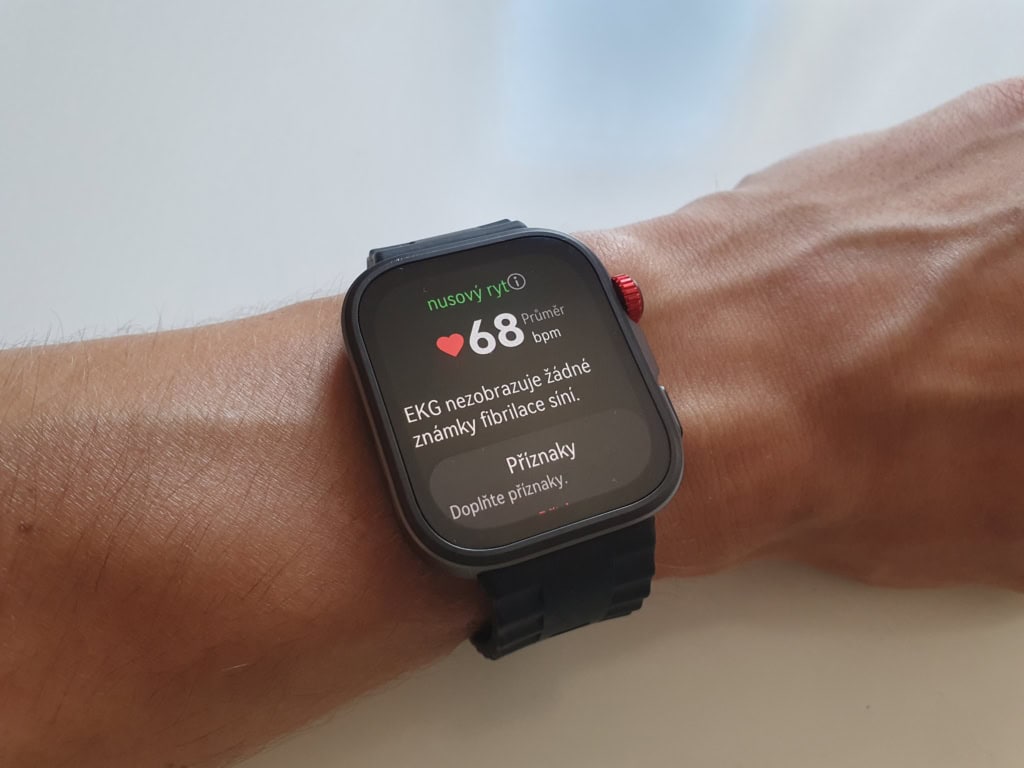 EKG mérés